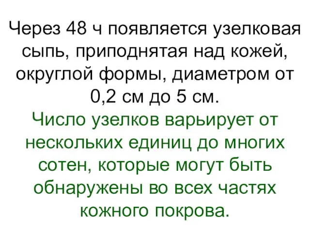 Через 48 ч появляется узелковая сыпь, приподнятая над кожей, округлой формы,