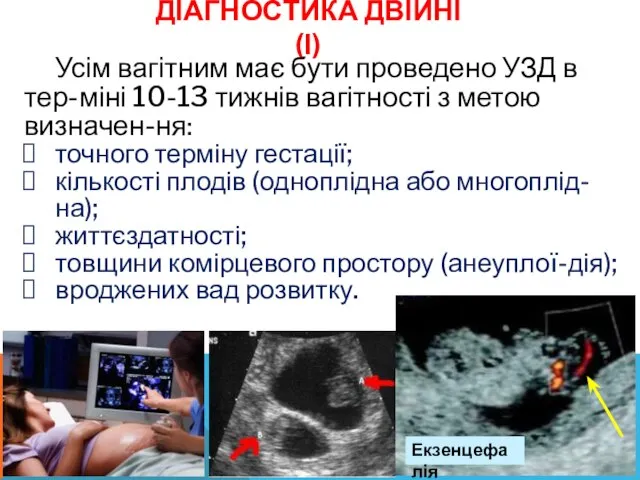 ДІАГНОСТИКА ДВІЙНІ (І) Усім вагітним має бути проведено УЗД в тер-міні