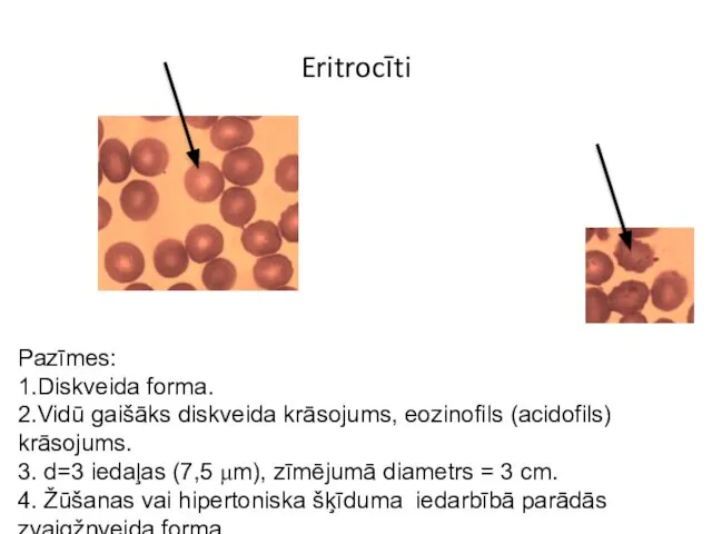 Eritrocīti Pazīmes: 1.Diskveida forma. 2.Vidū gaišāks diskveida krāsojums, eozinofils (acidofils) krāsojums.