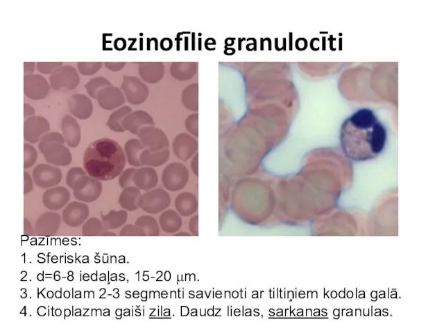 Eozinofīlie granulocīti Pazīmes: 1. Sferiska šūna. 2. d=6-8 iedaļas, 15-20 μm.