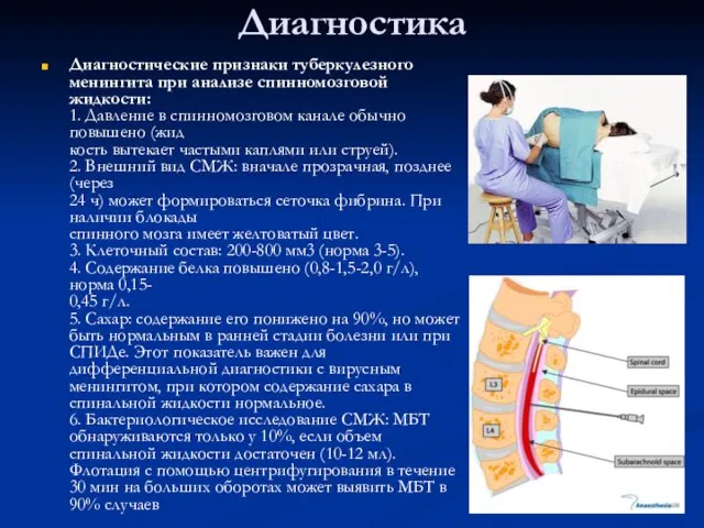 Диагностика Диагностические признаки туберкулезного менингита при анализе спинномозговой жидкости: 1. Давление