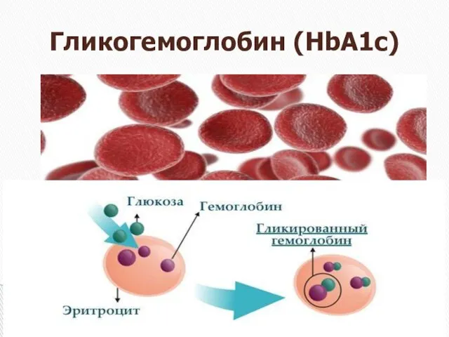 Гликогемоглобин (HbA1c)