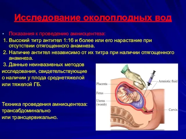 Исследование околоплодных вод Показания к проведению амниоцентеза: 1. Высокий титр антител