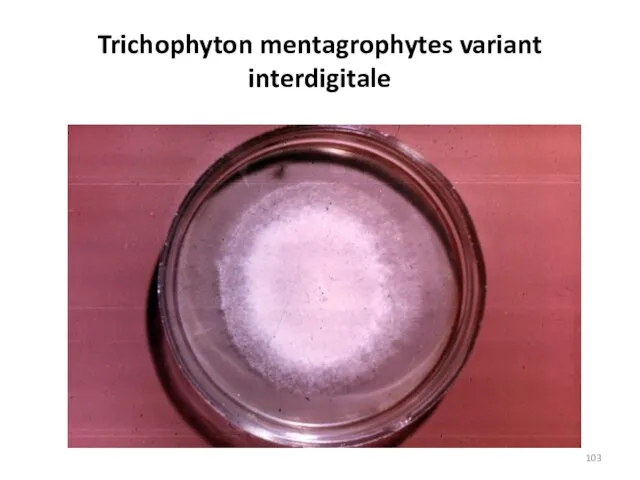 Trichophyton mentagrophytes variant interdigitale