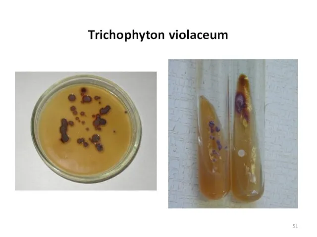 Trichophyton violaceum