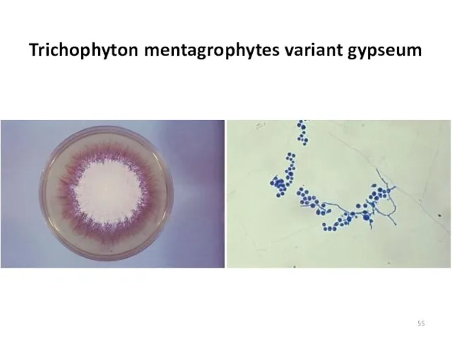 Trichophyton mentagrophytes variant gypseum