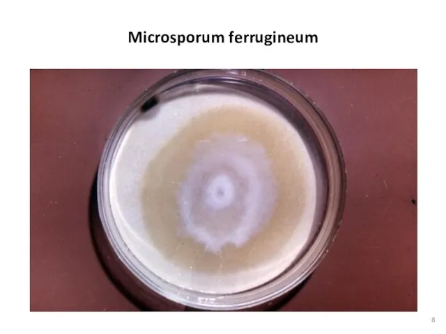 Microsporum ferrugineum