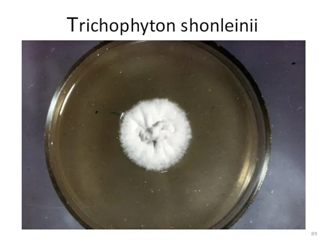 Тrichophyton shonleinii