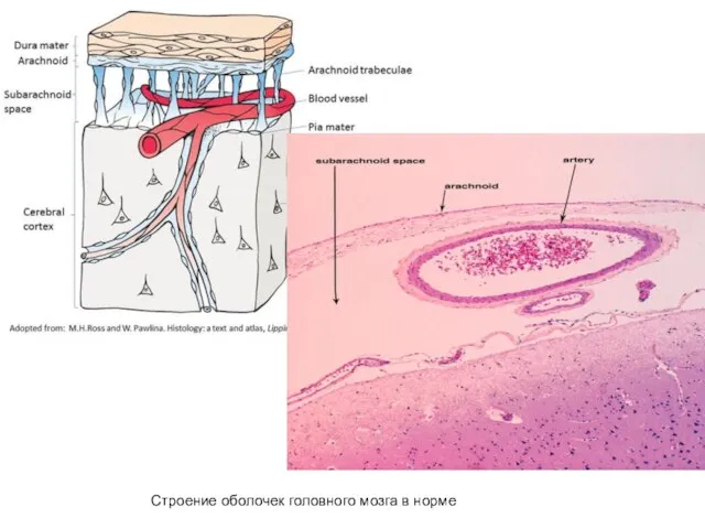 Строение оболочек головного мозга в норме