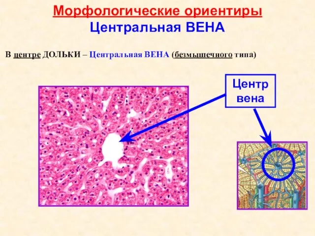 Морфологические ориентиры Центральная ВЕНА Центр вена В центре ДОЛЬКИ – Центральная ВЕНА (безмышечного типа)