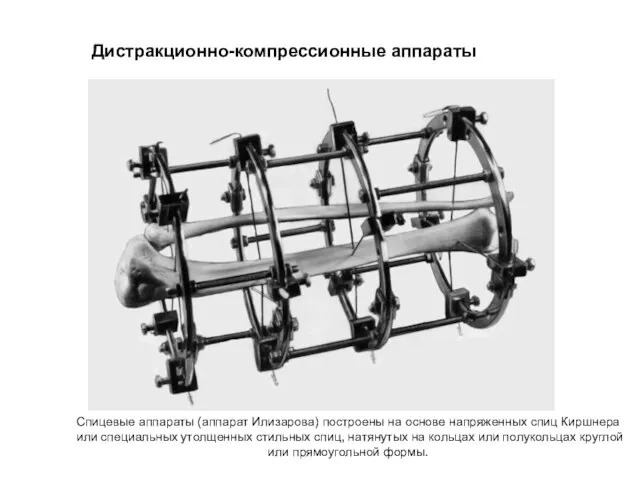 Дистракционно-компрессионные аппараты Спицевые аппараты (аппарат Илизарова) построены на основе напряженных спиц