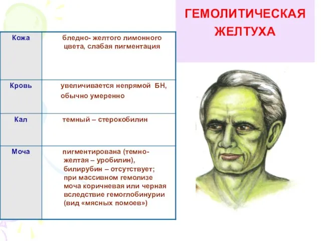 ГЕМОЛИТИЧЕСКАЯ ЖЕЛТУХА