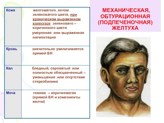 МЕХАНИЧЕСКАЯ, ОБТУРАЦИОННАЯ (ПОДПЕЧЕНОЧНАЯ) ЖЕЛТУХА