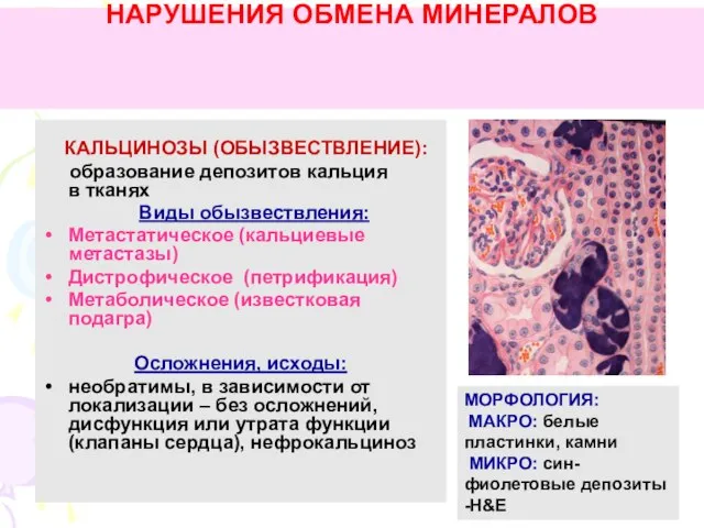 НАРУШЕНИЯ ОБМЕНА МИНЕРАЛОВ КАЛЬЦИНОЗЫ (ОБЫЗВЕСТВЛЕНИЕ): образование депозитов кальция в тканях Виды