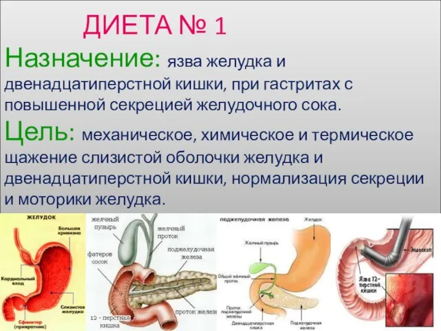 ДИЕТА № 1 Назначение: язва желудка и двенадцатиперстной кишки, при гастритах