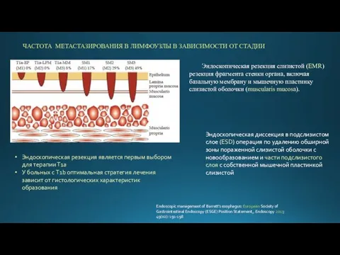 ЧАСТОТА МЕТАСТАЗИРОВАНИЯ В ЛИМФОУЗЛЫ В ЗАВИСИМОСТИ ОТ СТАДИИ Эндоскопическая резекция является