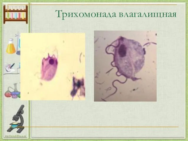 Трихомонада влагалищная