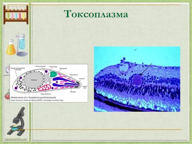 Токсоплазма