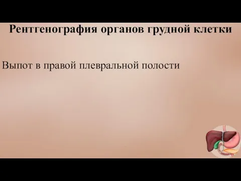 Рентгенография органов грудной клетки Выпот в правой плевральной полости