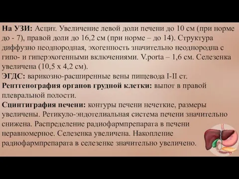 На УЗИ: Асцит. Увеличение левой доли печени до 10 см (при