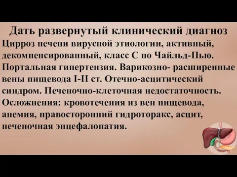 Дать развернутый клинический диагноз Цирроз печени вирусной этиологии, активный, декомпенсированный, класс