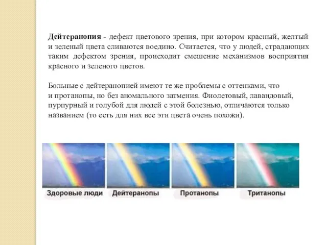 Дейтеранопия - дефект цветового зрения, при котором красный, желтый и зеленый