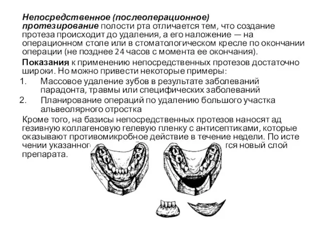 Непосредственное (послеоперационное) протезирование полости рта отличается тем, что создание протеза происходит