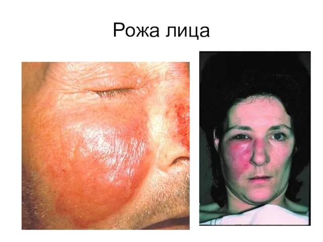 Рожа лица