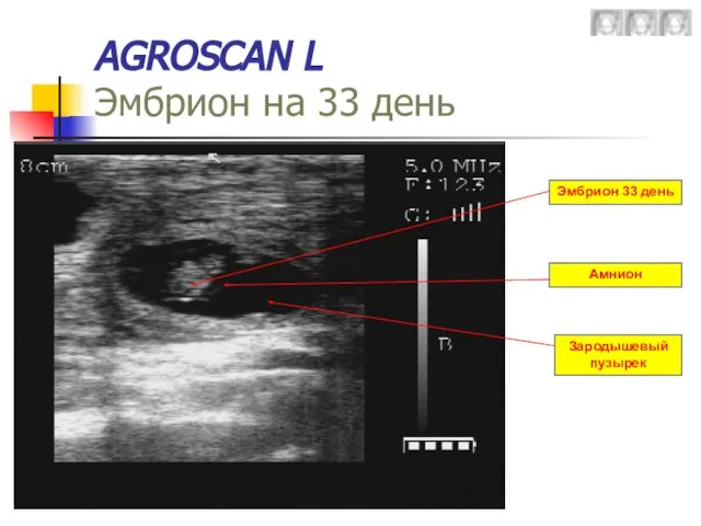 AGROSCAN L Эмбрион на 33 день Эмбрион 33 день Зародышевый пузырек Амнион