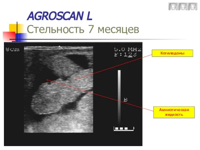 AGROSCAN L Стельность 7 месяцев Котиледоны Амниотическая жидкость