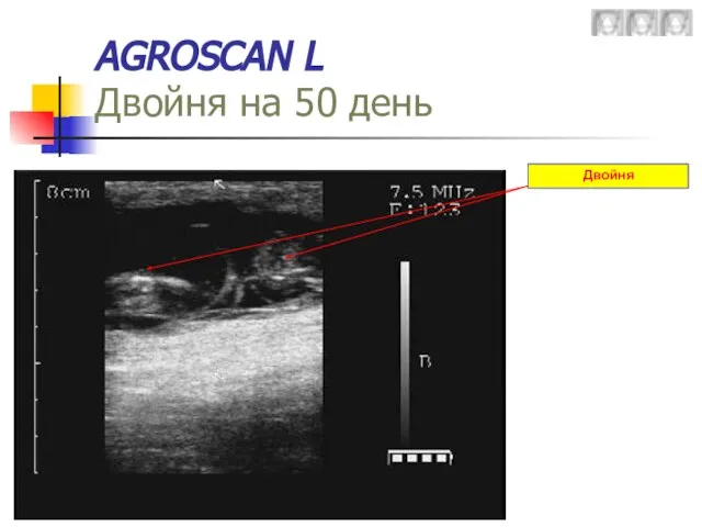 AGROSCAN L Двойня на 50 день Двойня