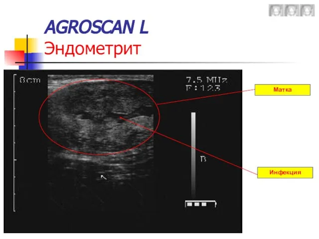 AGROSCAN L Эндометрит Матка Инфекция