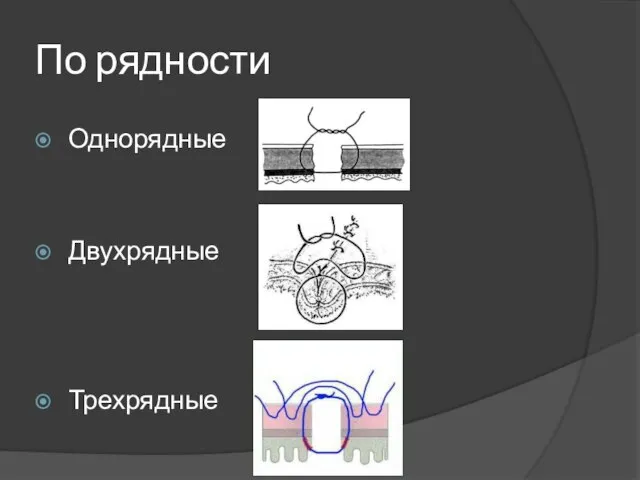 По рядности Однорядные Двухрядные Трехрядные