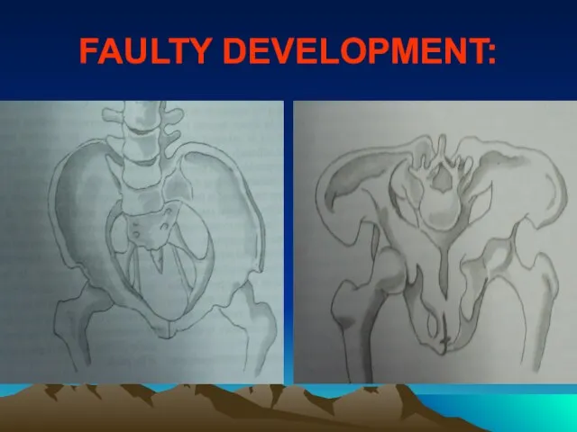 FAULTY DEVELOPMENT: