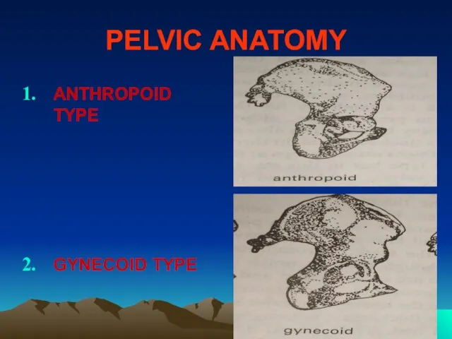 PELVIC ANATOMY ANTHROPOID TYPE GYNECOID TYPE