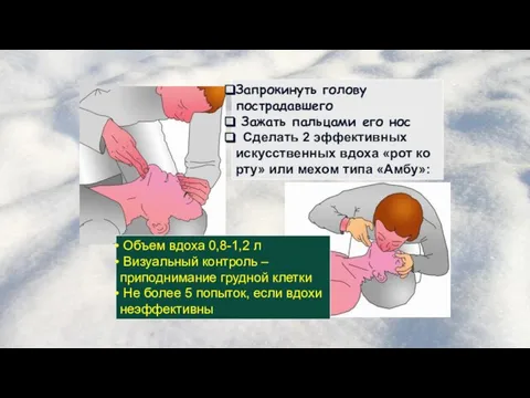 Объем вдоха 0,8-1,2 л Визуальный контроль – приподнимание грудной клетки Не