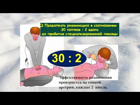 Продолжать реанимацию в соотношении 30 толчков : 2 вдоха до прибытия специализированной помощи