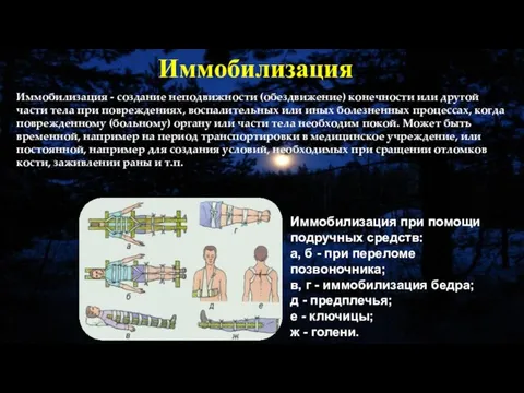 Иммобилизация - создание неподвижности (обездвижение) конечности или другой части тела при