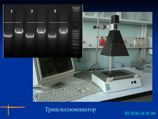 Трансиллюминатор