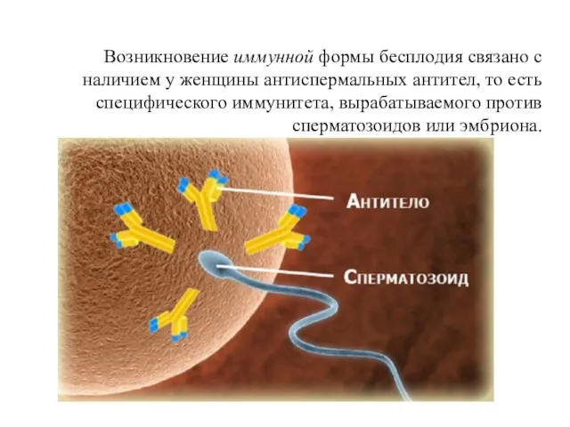 Возникновение иммунной формы бесплодия связано с наличием у женщины антиспермальных антител,