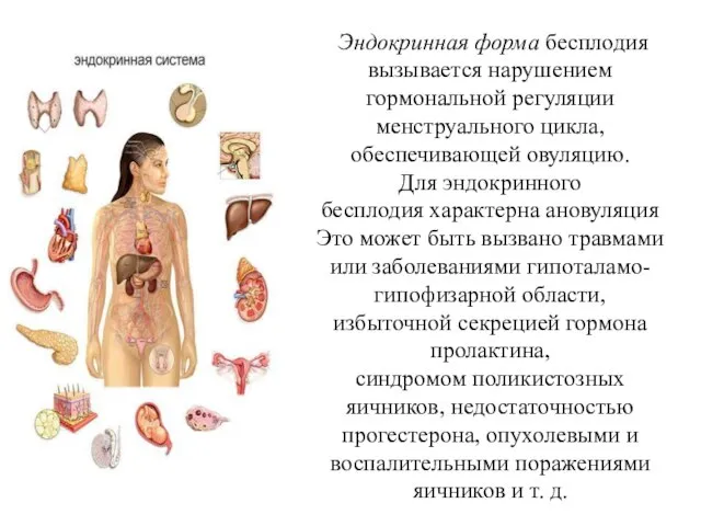 Эндокринная форма бесплодия вызывается нарушением гормональной регуляции менструального цикла, обеспечивающей овуляцию.