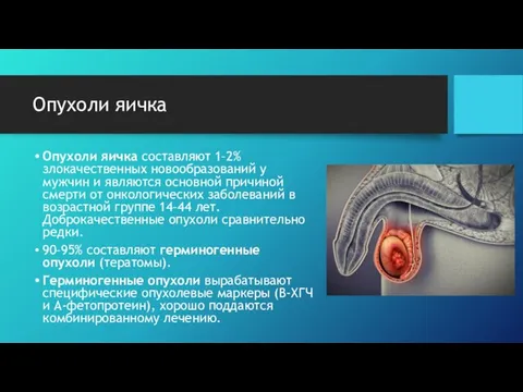 Опухоли яичка Опухоли яичка составляют 1–2% злокачественных новообразований у мужчин и