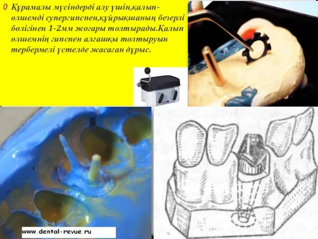 Құрамалы мүсіндерді алу үшін,қалып-өлшемді супергипспен,құйрықшаның безерлі бөлігінен 1-2мм жоғары толтырады.Қалып өлшемнің