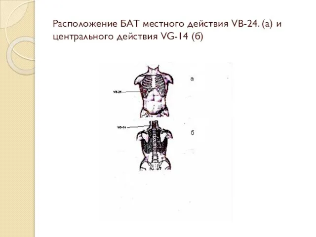 Расположение БАТ местного действия VB-24. (а) и центрального действия VG-14 (б)