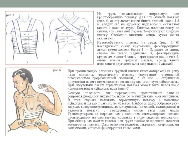 При проникающих ранениях грудной клетки (пневмотораксе) на рану надо наложить герметичную