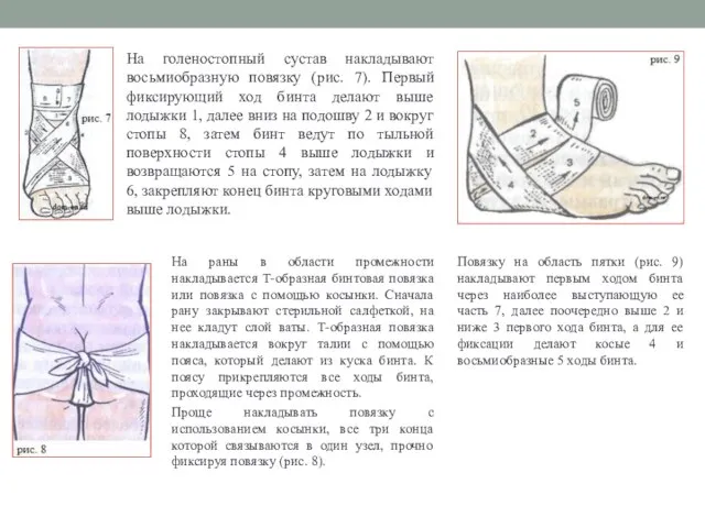 Повязку на область пятки (рис. 9) накладывают первым ходом бинта через