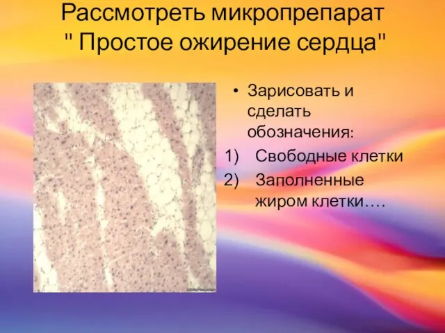 Рассмотреть микропрепарат " Простое ожирение сердца" Зарисовать и сделать обозначения: Свободные клетки Заполненные жиром клетки….