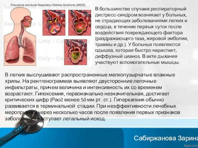 В легких выслушивают распространенные мелкопузырчатые влажные хрипы. На рентгенограммах выявляют двусторонние