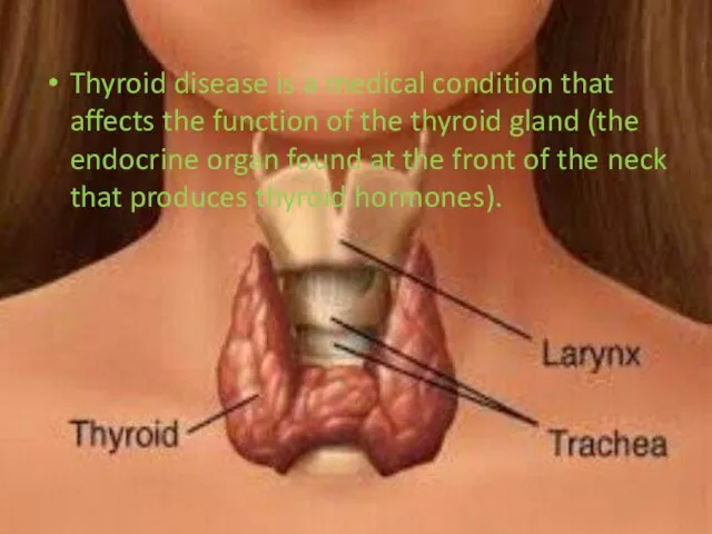 Thyroid disease is a medical condition that affects the function of