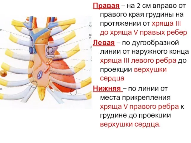 Правая – на 2 см вправо от правого края грудины на